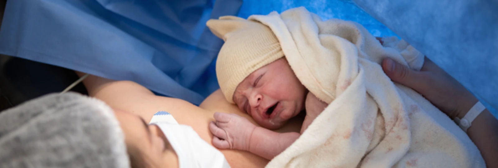 baby after being born via c-section on mothers chest